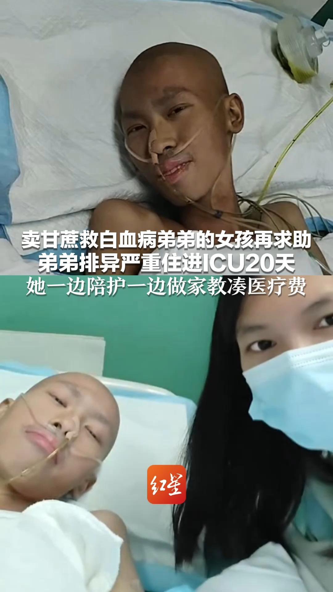 卖甘蔗救白血病弟弟的女孩再求助 弟弟排异严重住进ICU20天 她一边陪护一边做家教凑医疗费 “从小就照顾他 不会放弃”