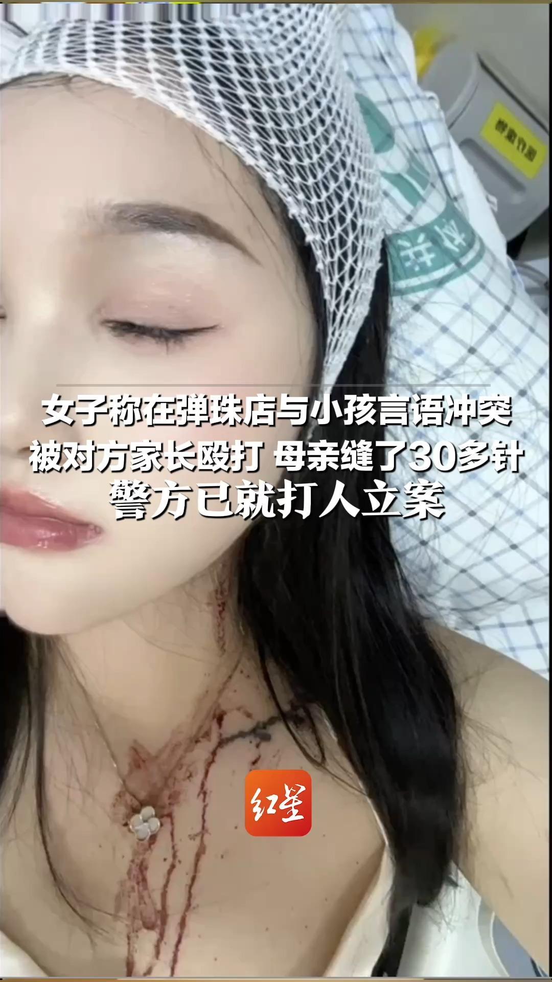 女子称在弹珠店与小孩言语冲突 被对方家长殴打 母亲缝了30多针 警方已就打人立案