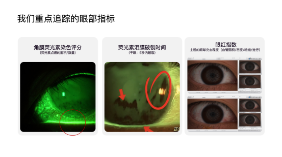 OPPO宣布将医学指标引入护眼研发 下代Find旗舰率先应用研究成果