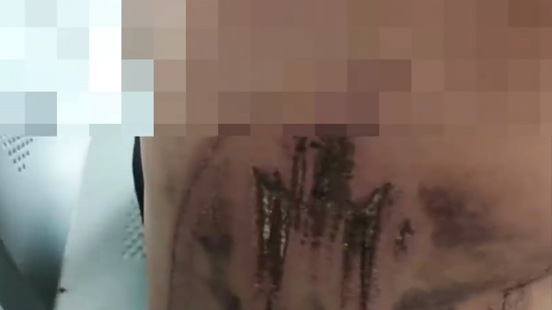 湖北恩施一村民称干农活被老虎抓伤？林业局通报