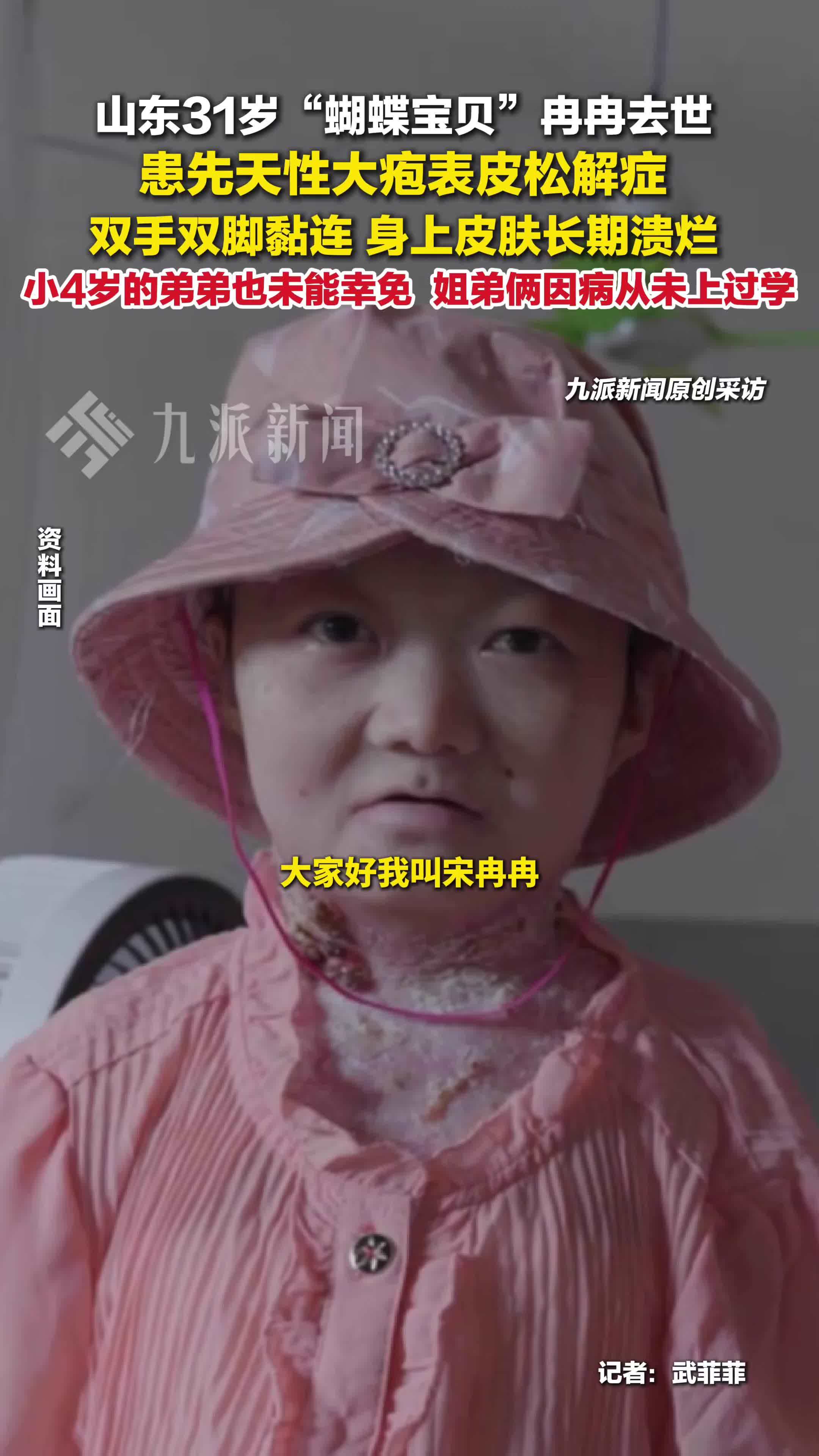山东31岁蝴蝶宝贝冉冉去世