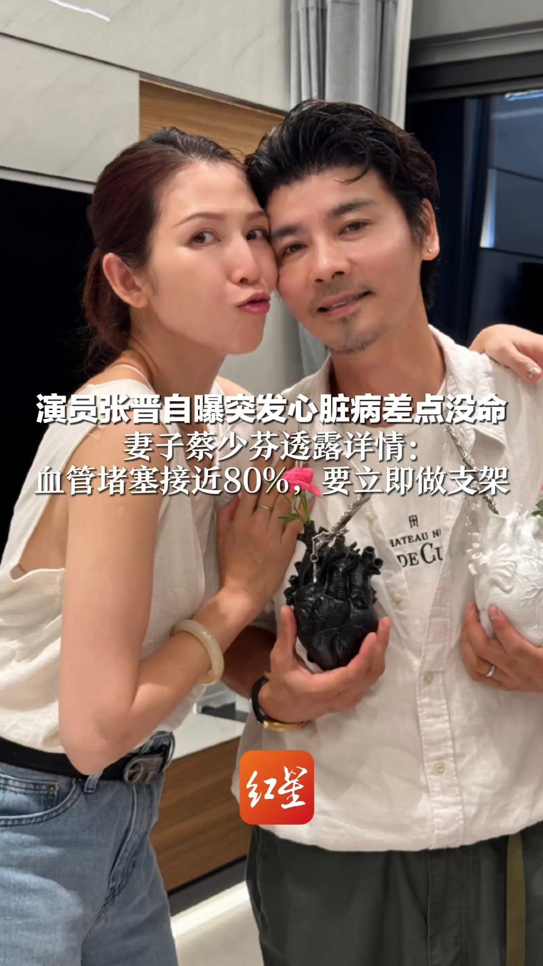 演员张晋自曝突发心脏病差点没命    妻子蔡少芬透露详情： 血管堵塞接近80%，要立即做支架 “如果他有事，我真的会疯”