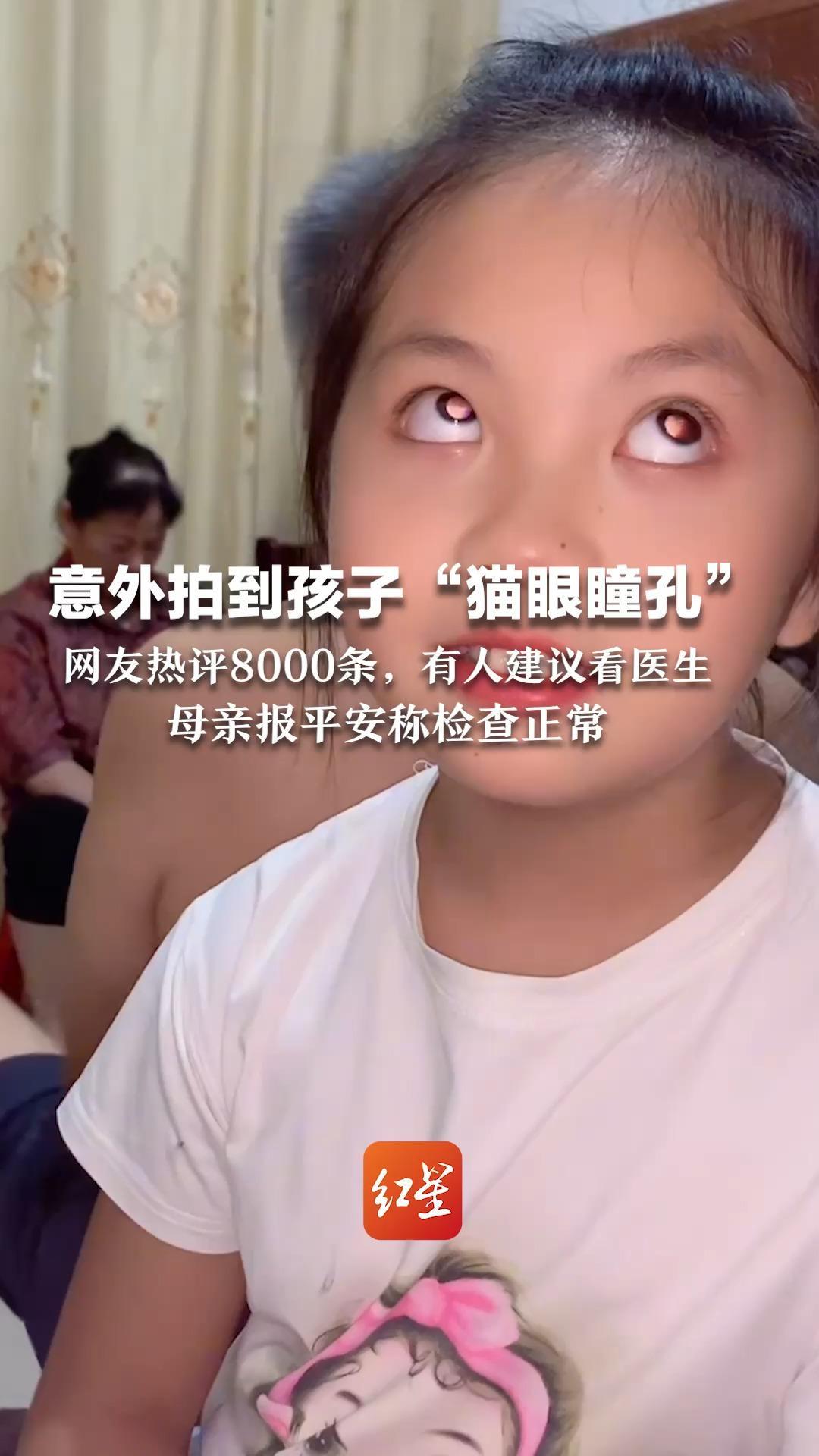 意外拍到孩子“猫眼瞳孔” 网友热评8000条，有人建议看医生 母亲报平安称检查正常 幸好是虚惊一场