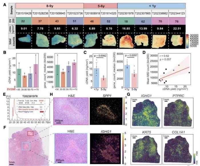 Stereo-seq　V2应用于不同保存年限的FFPE乳腺癌样本　华大供图