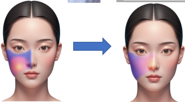 面部微生态分布热力图