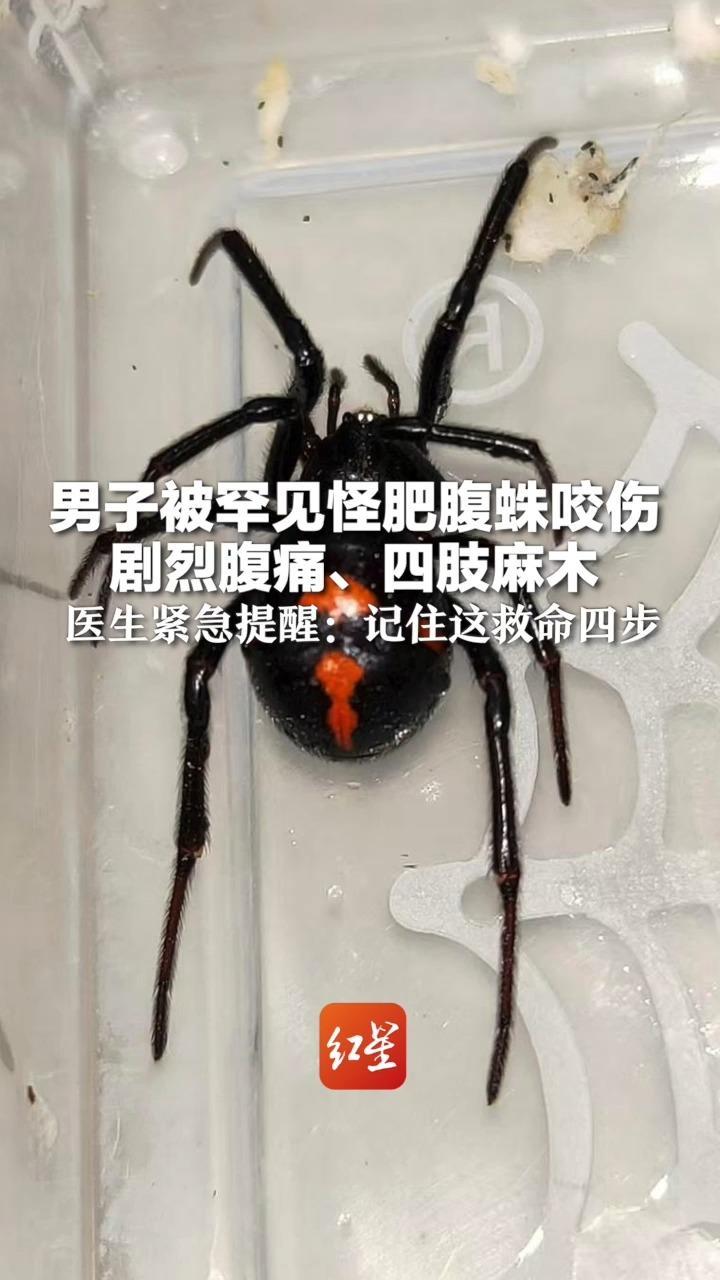 “黑寡妇”近亲！男子被罕见怪肥腹蛛咬伤  剧烈腹痛、四肢麻木 医生紧急提醒：记住这救命四步