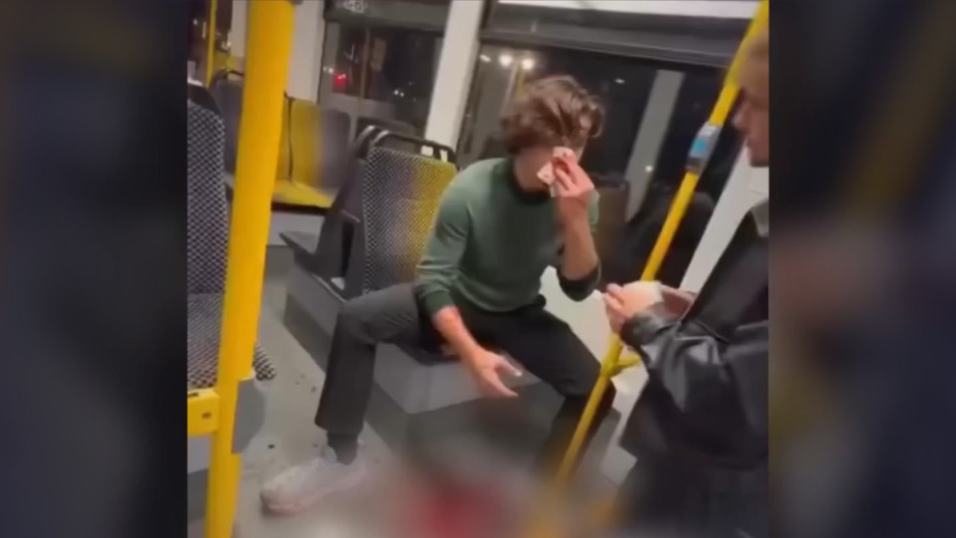 美国21岁模特在德国见义勇为被毁容：“我会骄傲地戴着我的伤疤”