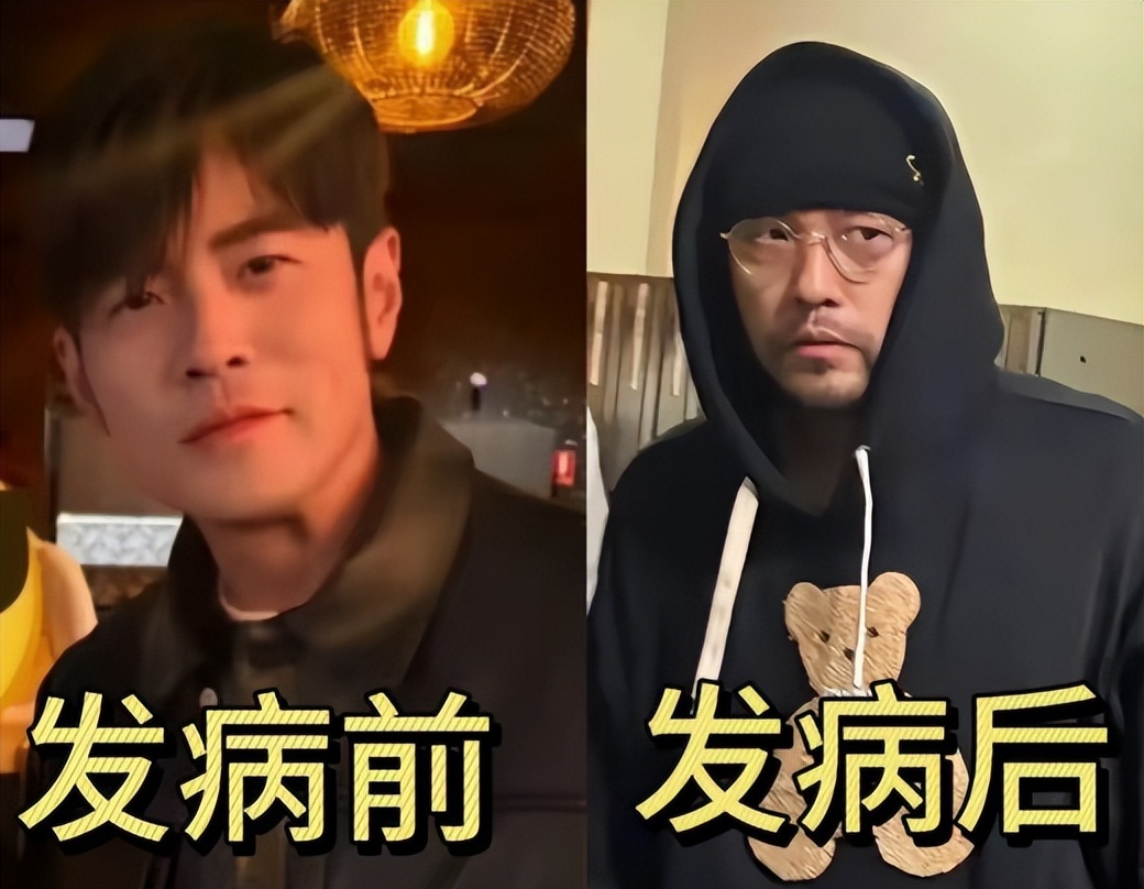 钱再多有什么用！46岁周杰伦现状曝光！病情严重到走路需要人搀扶(图23)