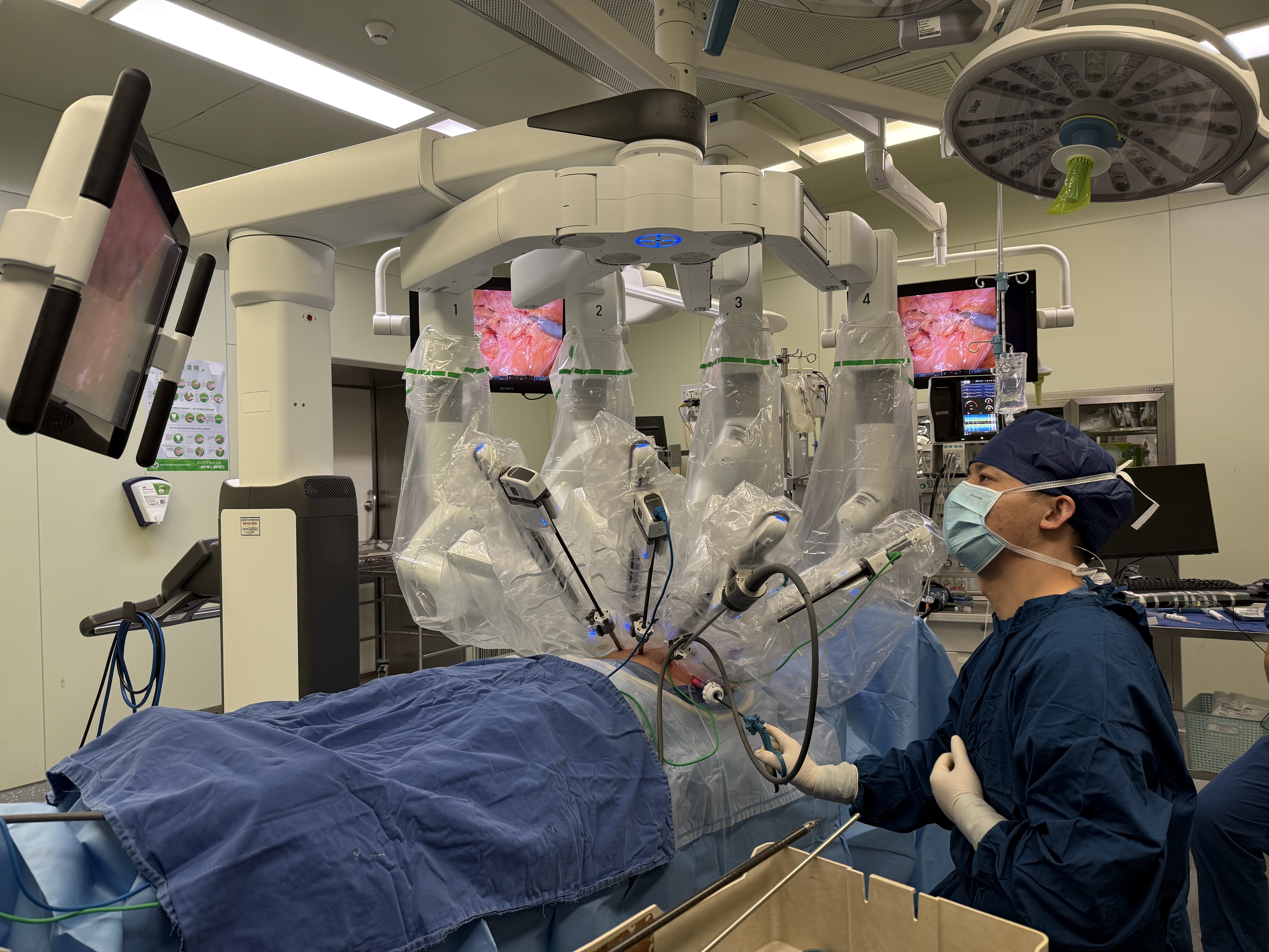 中大医院普外科石欣团队刘从兴主治医师手术中