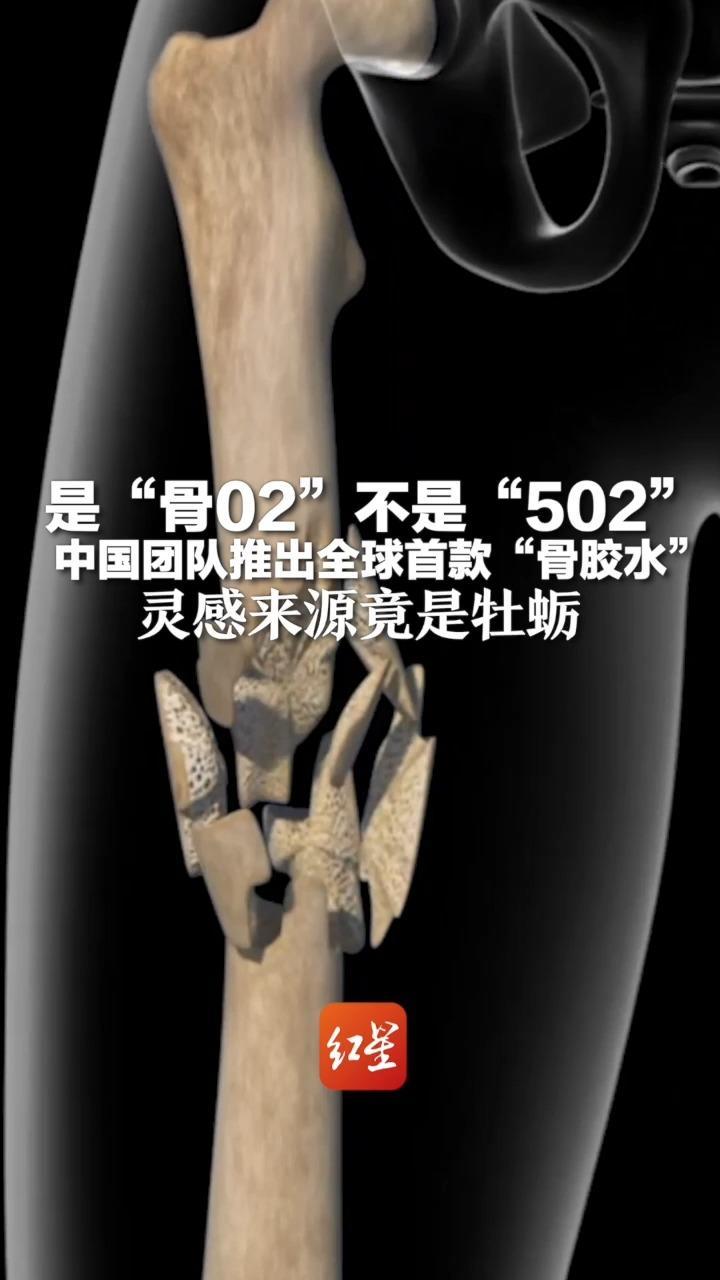 是“骨02”不是“502” 中国团队推出全球首款“骨胶水” 灵感来源竟是牡蛎 快速黏合使用便捷,可固定微小碎骨_凤凰网视频_凤凰网
