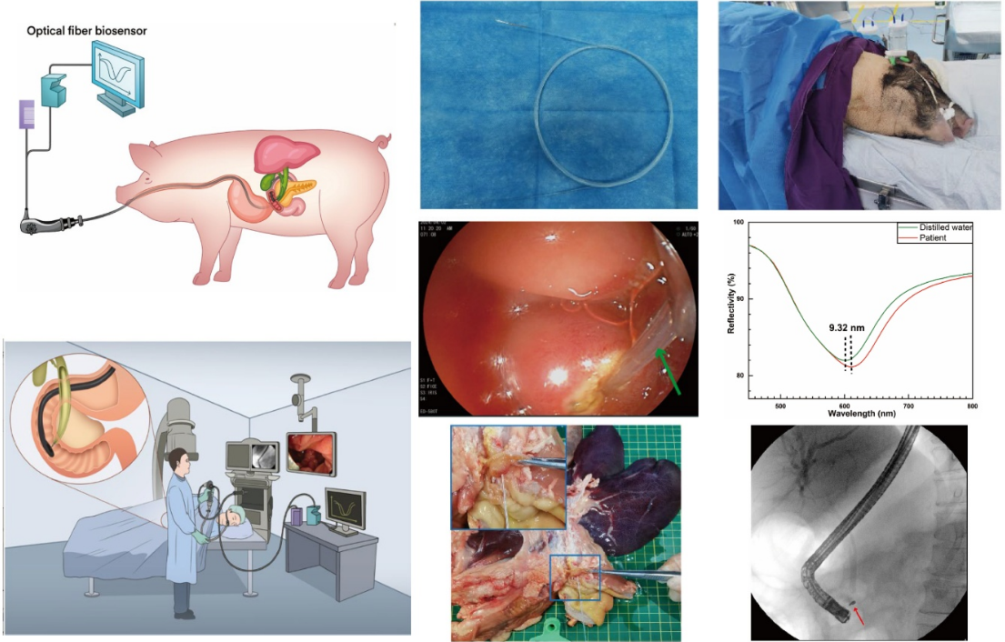 图3.实验动物体内验证及临床实验