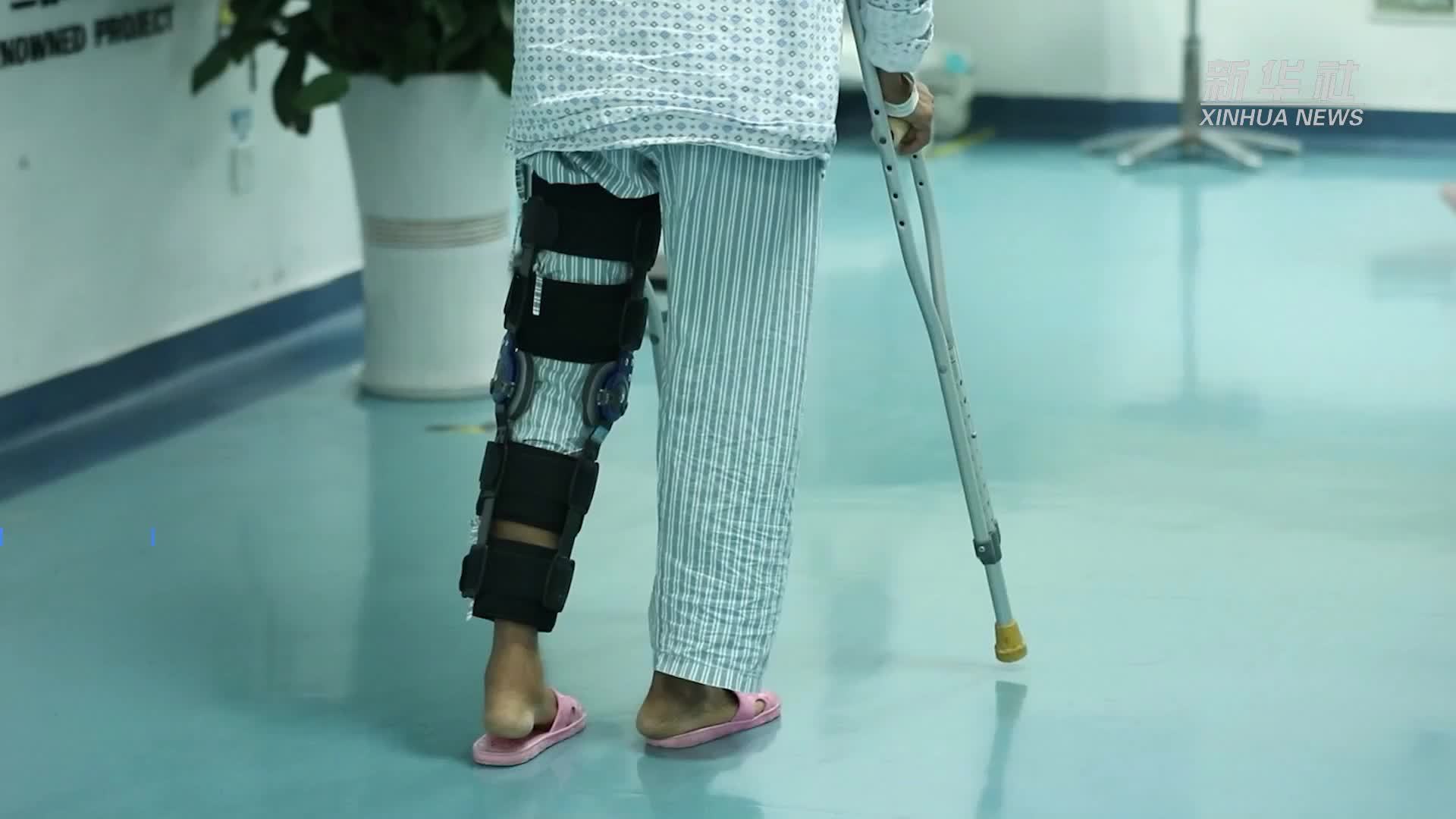 打一针“胶水”就能治疗骨折 浙大研究者自主研发“骨胶水”实现突破