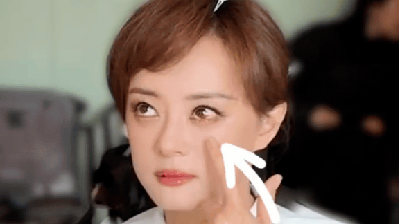 孙俪回应左眼受伤称“被球撞了”！封面图