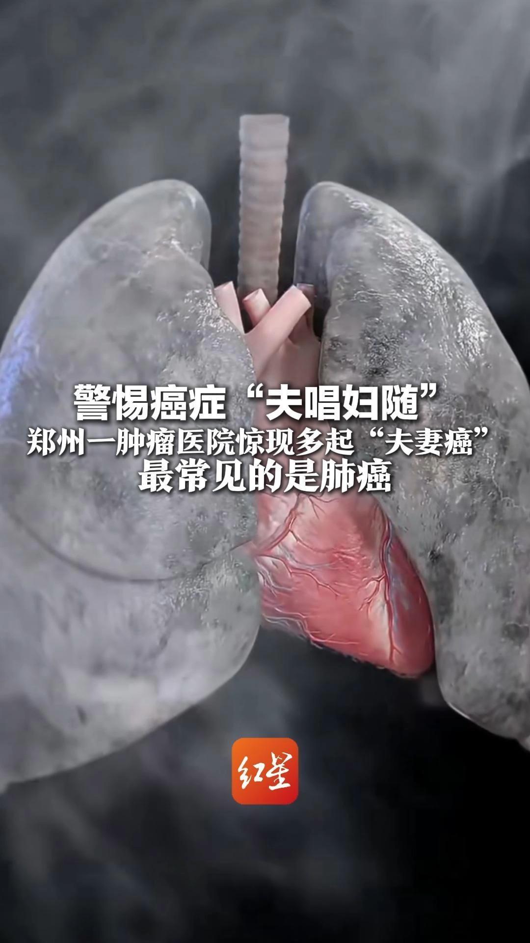 警惕癌症“夫唱妇随”郑州一肿瘤医院惊现多起“夫妻癌”最常见的是肺癌 医生：远离烟草就是对家人最好的守护