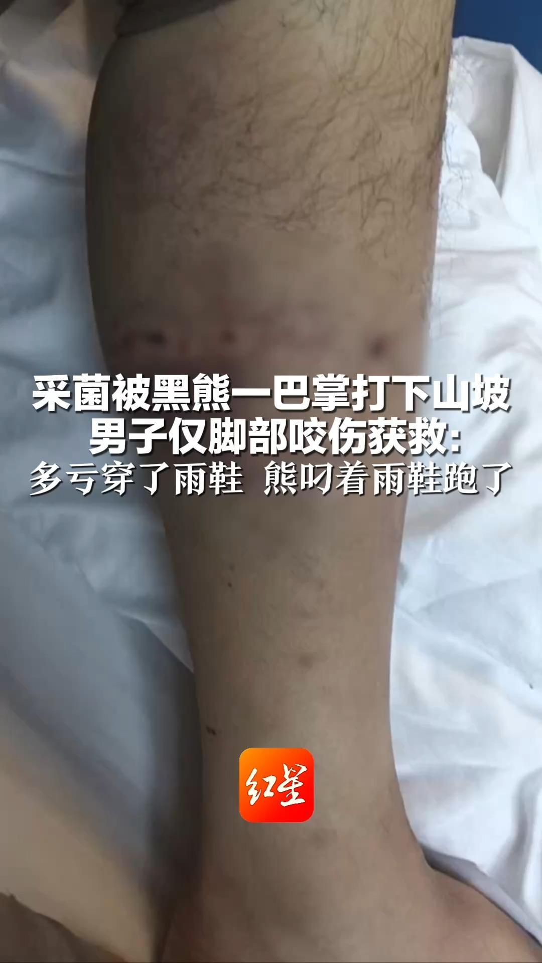 幸运！采菌被黑熊一巴掌打下山坡 男子仅脚部咬伤获救：多亏穿了雨鞋 熊叼着雨鞋跑了