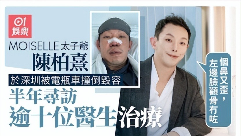 香港富二代遭车祸严重毁容，近照面目全非，自曝曾找十多位医生修复封面图