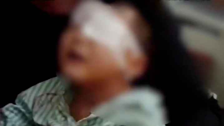 被戳伤失明男孩家长回应获赔272万：网传不实，初次协商费用是27万