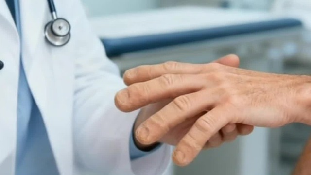 手指出现这种情况，说明的你的心和肺可能都出现了问题