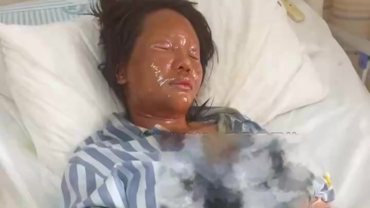 女主播被炸弹包裹炸伤面部，“恶意报复，已知道是谁”，警方介入