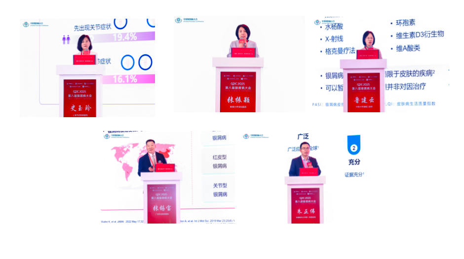 第八届银屑病大会:多维视角探前沿