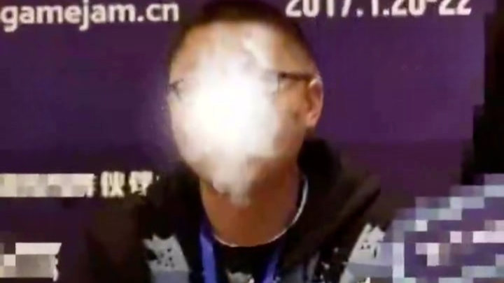 33岁男子摘镜8年后视力恢复：戴眼镜10年从100度增至400度，结果不是真近视