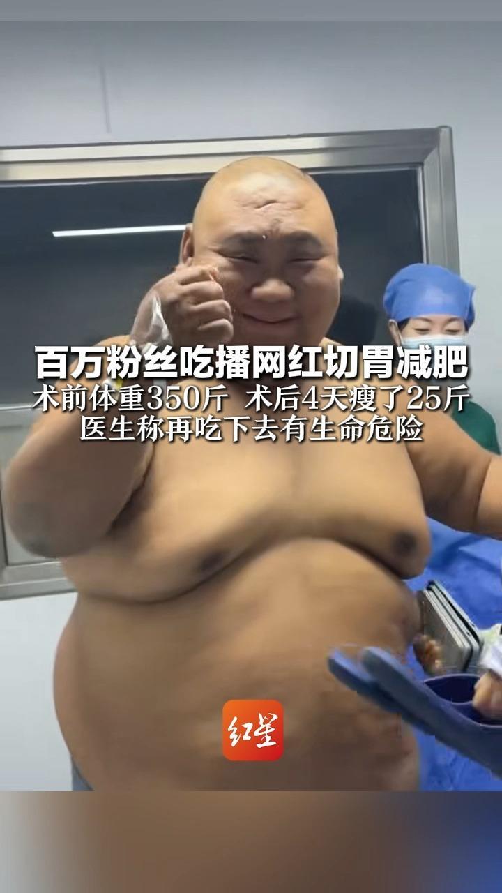 百万粉丝吃播网红切胃减肥 术前体重350斤 术后4天瘦了25斤 “不是我钱赚够了 是我想明白了” 医生称再吃下去有生命危险