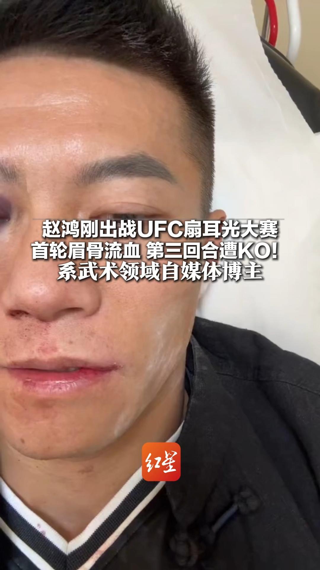 赵鸿刚出战UFC扇耳光大赛 首轮眉骨流血，第三回合遭KO！系武术领域自媒体博主 常发徒手打弯扳手、指节开易拉罐视频