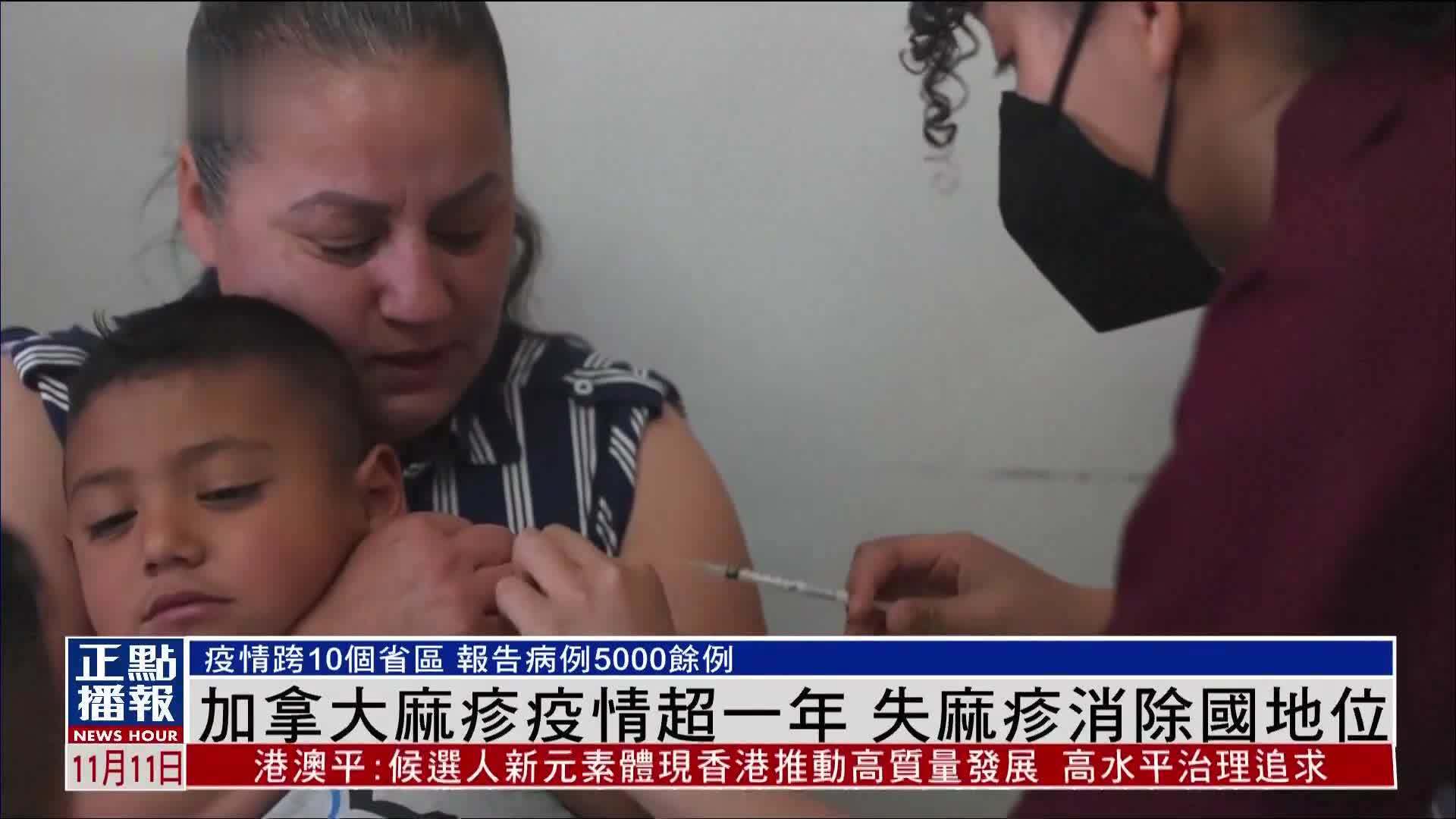 加拿大麻疹疫情超一年 失麻疹消除国地位