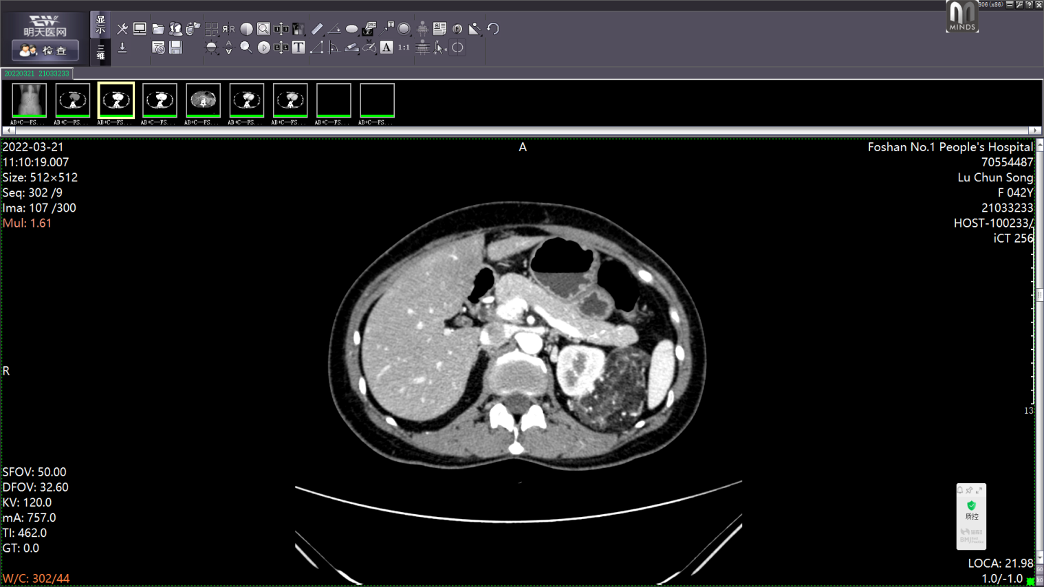 多学科广泛应用,“达芬奇”助推市一医院精准诊疗再攀高