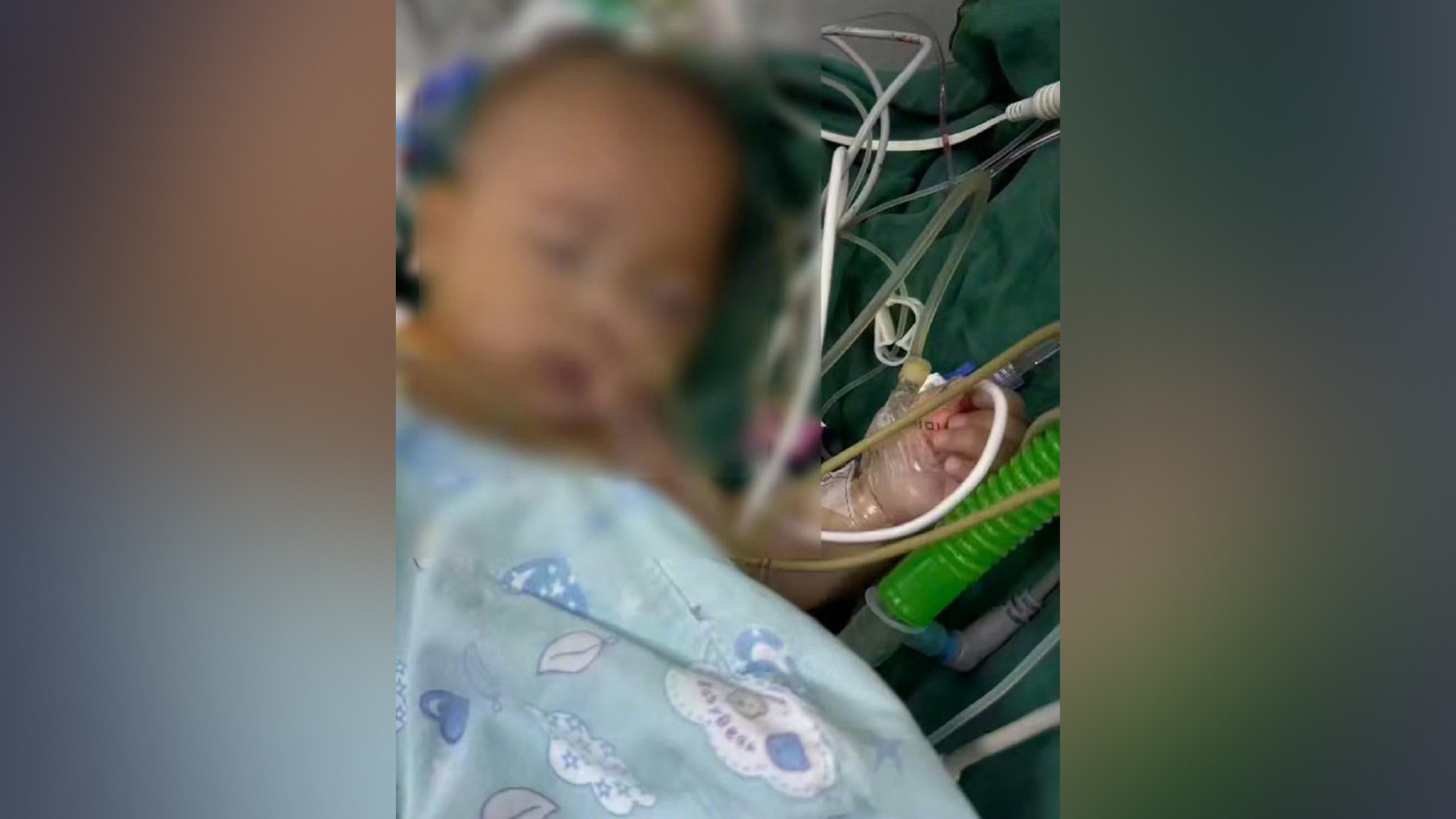 5月龄女婴心脏手术去世，医院回应：涉事医生已停诊，卫健委：在积极调查此事