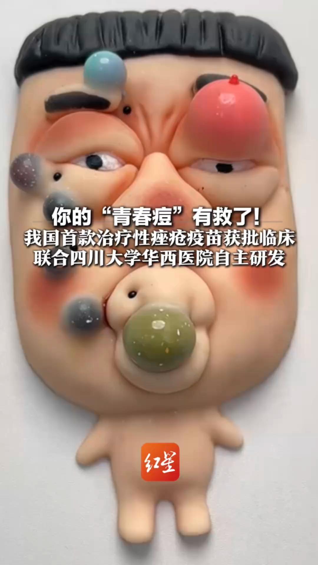 你的“青春痘”有救了！我国首款治疗性痤疮疫苗获批临床 联合四川大学华西医院自主研发 网友：这疫苗不太青春的人能打不？