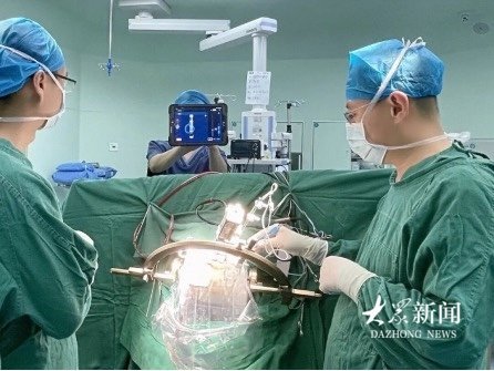 山东实施全国首例革新性国产脑机接口起搏器手术