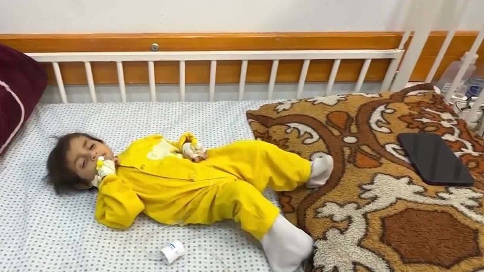 加沙饥荒导致儿童身心发展不良