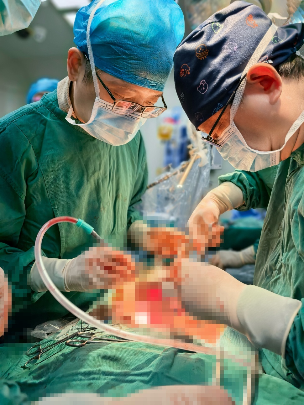 术中（左一：李明 右一：许林）