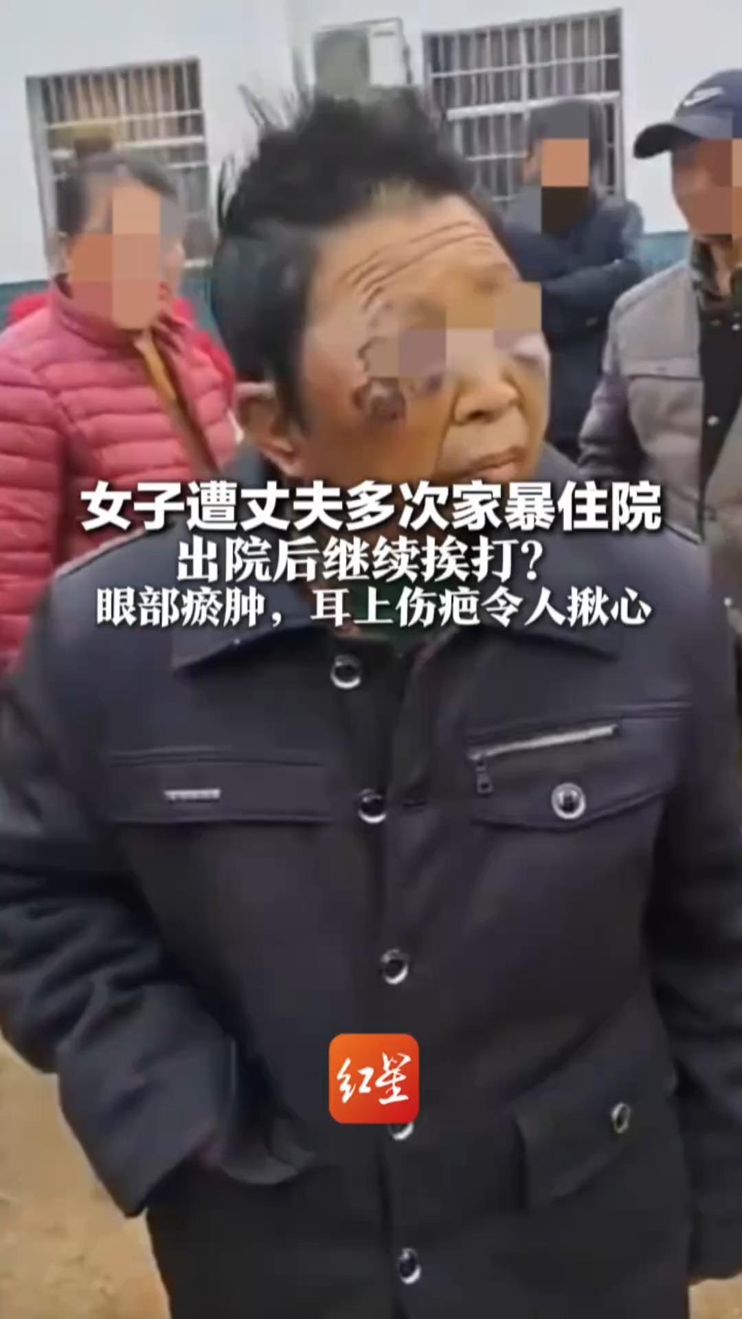 女子遭丈夫多次家暴住院 出院后继续挨打？眼部瘀肿，耳上伤疤令人揪心     当地多部门介入调查