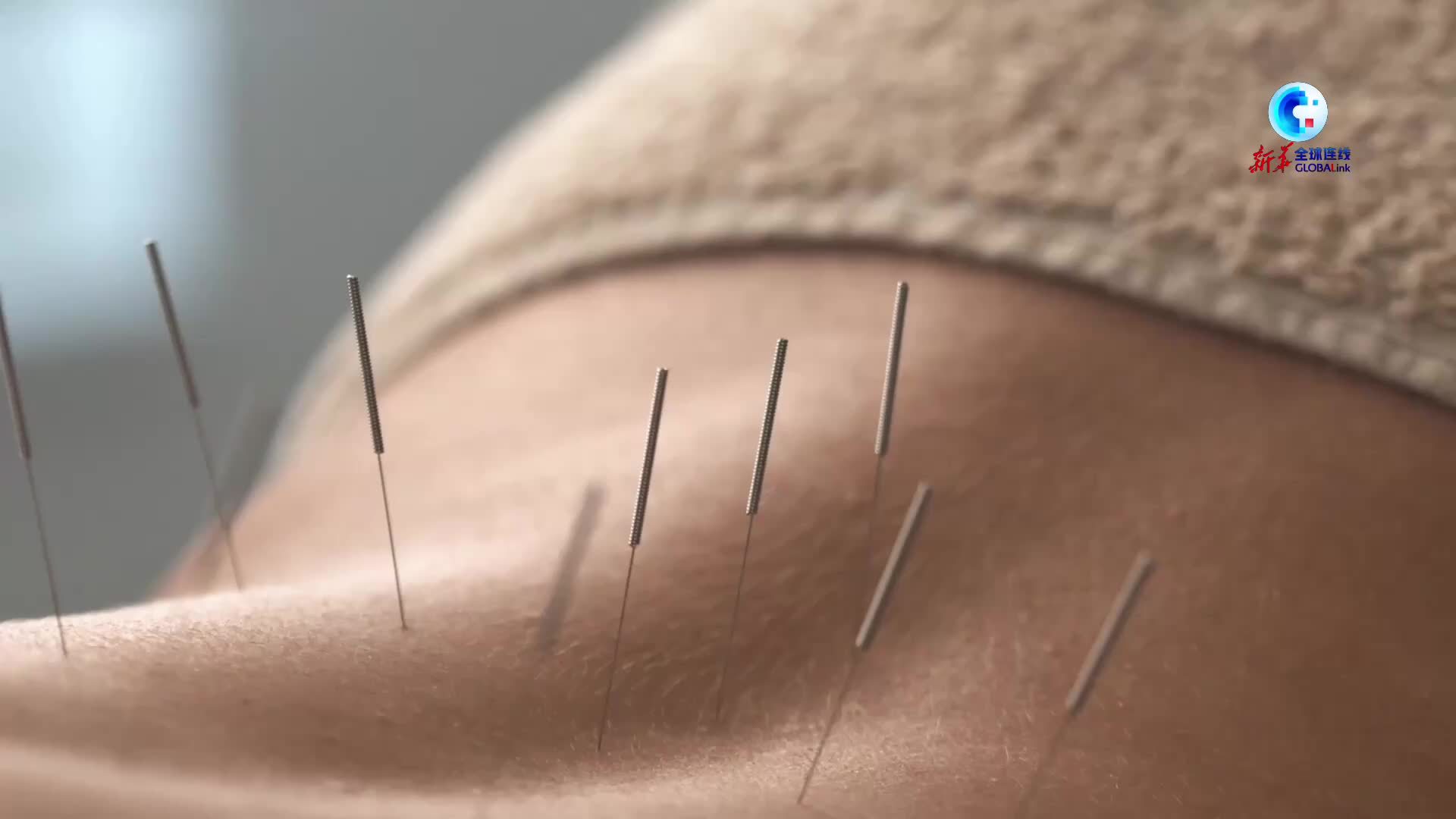 全球连线 | 8000公里巡回义诊 中国医生在非洲种下中医文化的“种子”