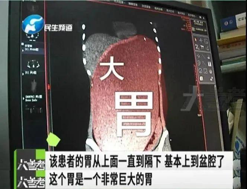 （来源：河南电视台民生频道）