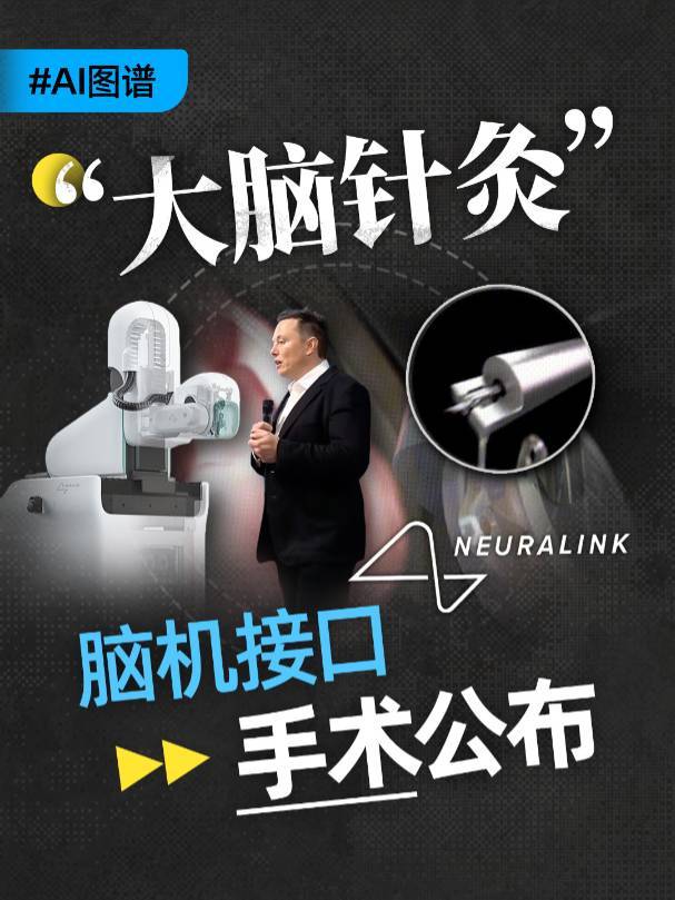 “1.5秒一次，128针的大脑针灸” Neuralink脑机接口手术全流程公布