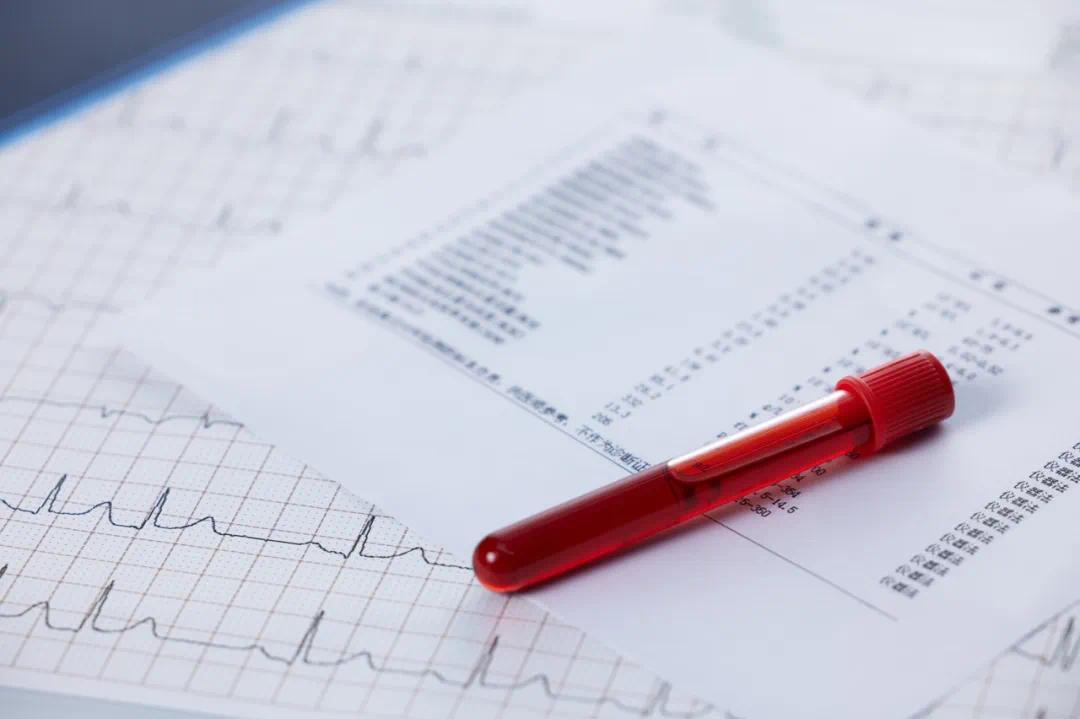 如何看懂生化报告　记住“肝、肾、糖、脂”四大模块