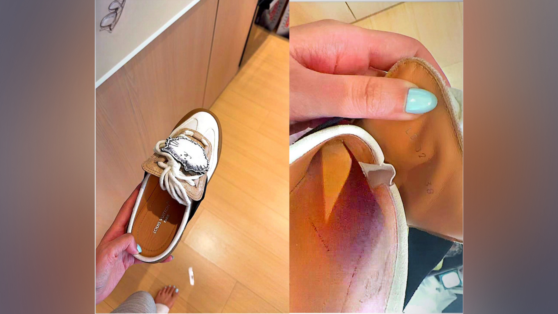 女子购近万元LV运动鞋，穿着只走了10分钟双脚伤痕累累，要求退款被拒，客服：不退，只能换