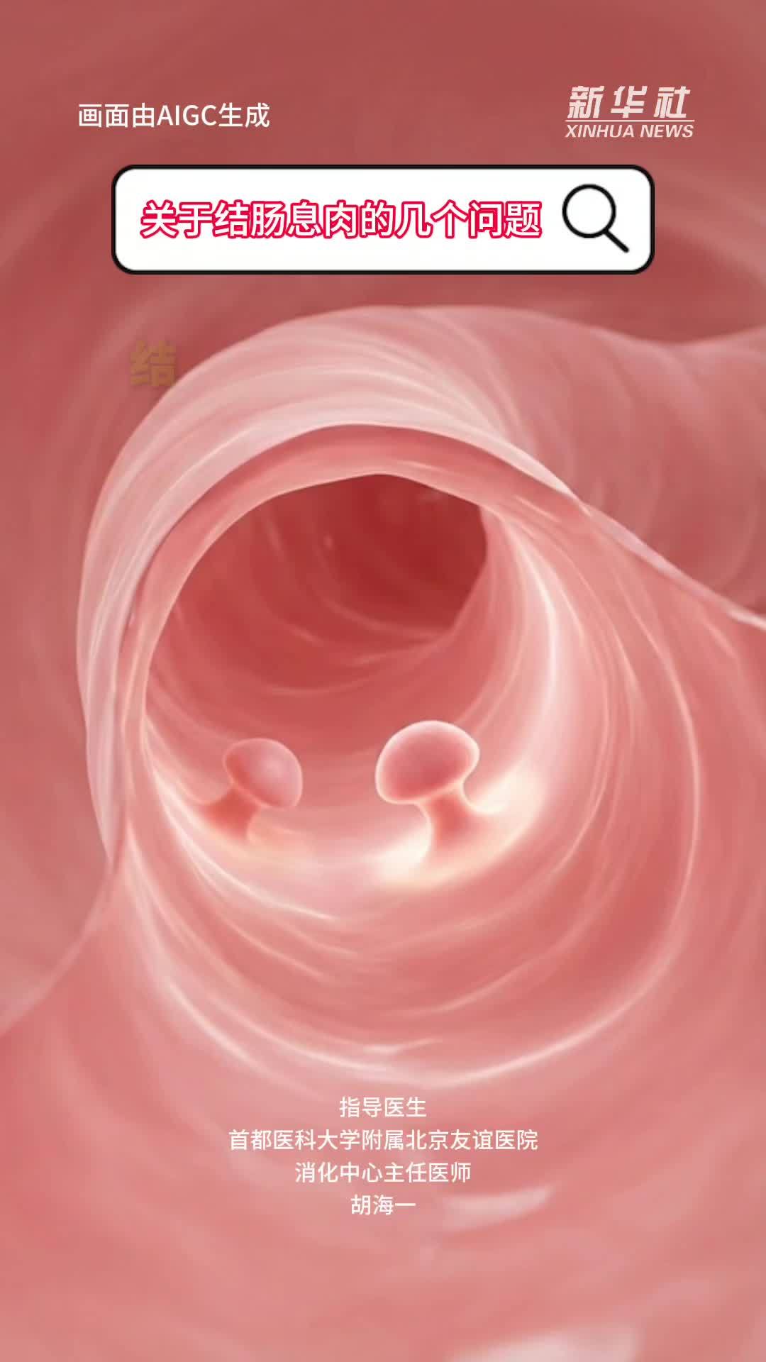 健康我来说｜关于结肠息肉的几个问题