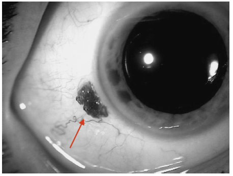 画面可能导致不适，谨慎点入