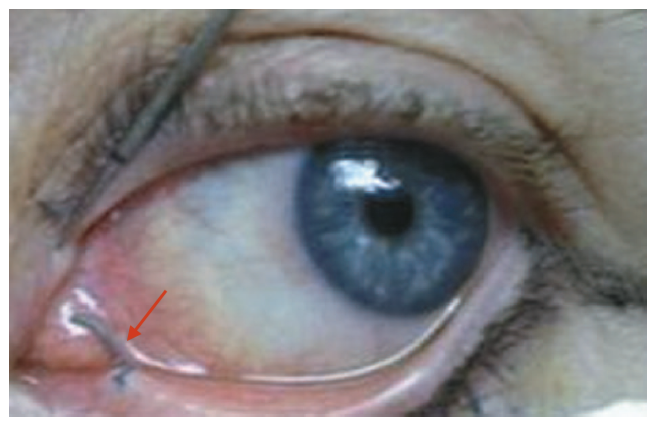 画面可能导致不适，谨慎点入