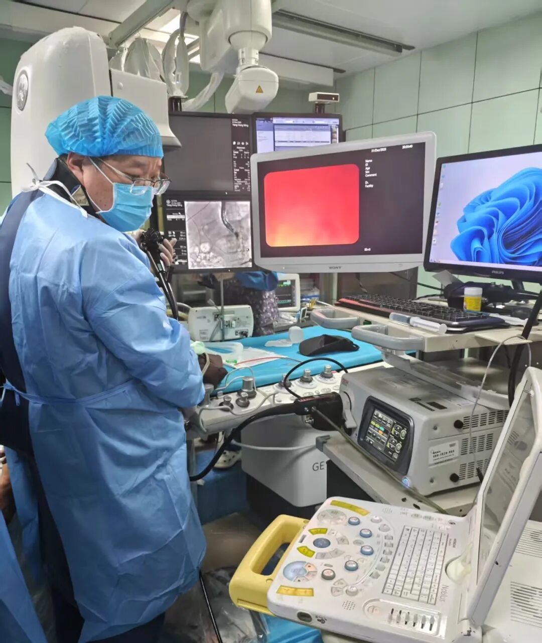 西安市第一医院消化内科完成院内首例超声内镜引导下胃空肠吻合术（EUS-GE）