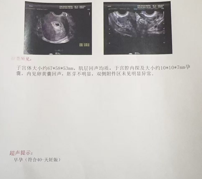 智塑未来, 宫腹腔镜消积水，精细调理促移植！花生&middot;五洲专家助二胎圆梦