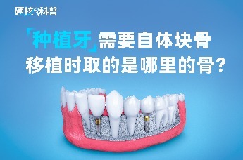 硬核科普：种植牙需要自体块骨移植时，取的是哪里的骨？