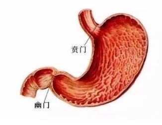 消失的饭?他明明吃了 胃里却没 一年消瘦20斤……