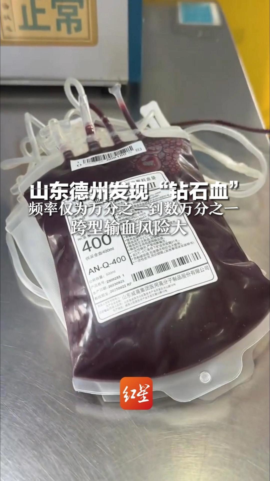 频率仅为万分之一到数万分之一！山东德州发现“钻石血”跨型输血风险巨大 必须匹配同型血