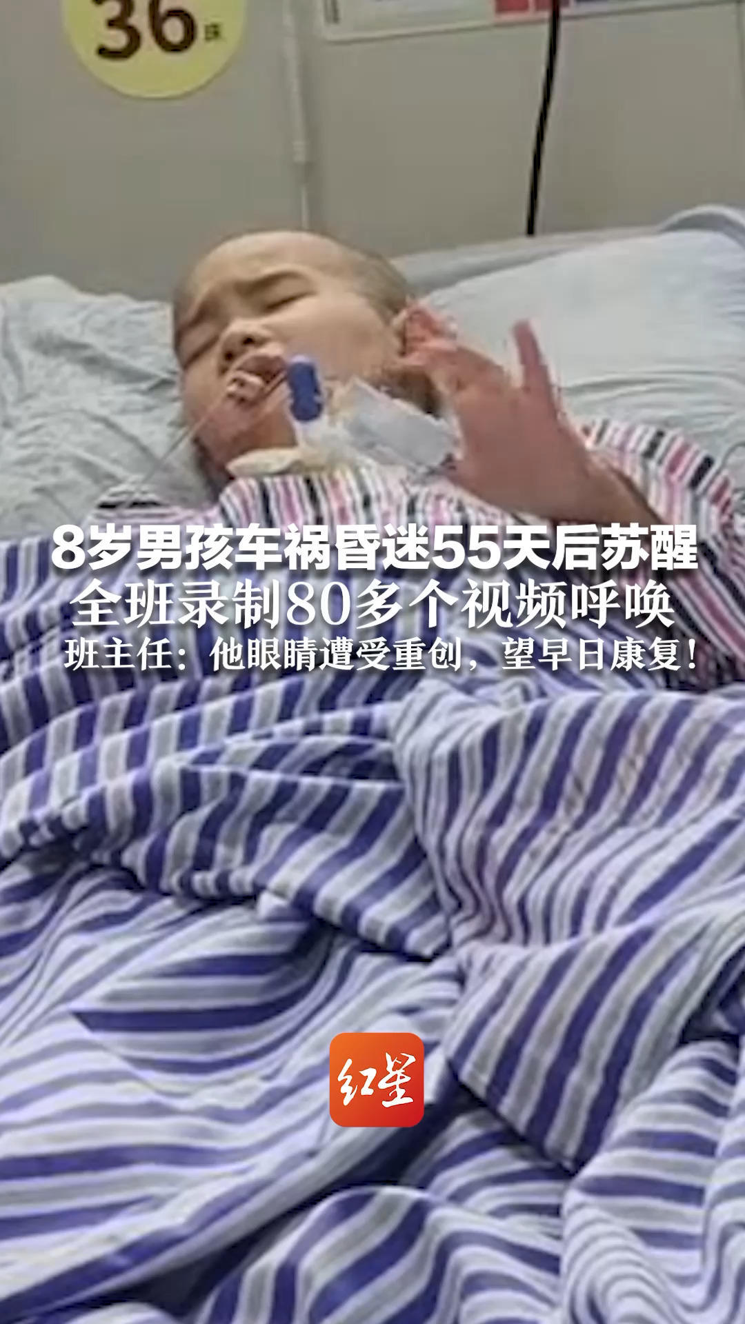 “刘楚熙，到你回答了！”8岁男孩车祸昏迷55天后苏醒 全班录制80多个视频呼唤 班主任：他眼睛遭受重创，望早日康复