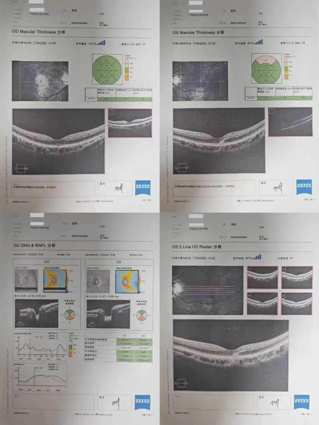 光学相关断层成像检查报告丨作者供图